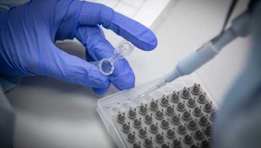 Coronavirus: comenzaron los ensayos de fase 2/3 de la vacuna argentina