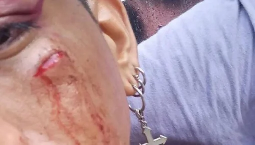 Ataque de homoodio a un joven a la salida de un boliche LGBTIQ+