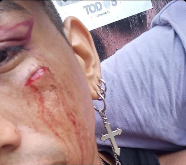 La herida que le dejó a Lautaro el ataque.