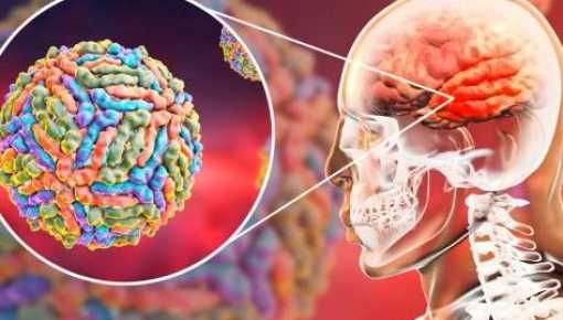 Alerta en Argentina: la Encefalitis Equina ya está en humanos